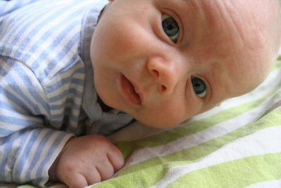 Белки глаз новорожденного. Желтые белки у новорожденных. Жёлтые белки глаз у новорожденных. Желтизна у новорожденного.